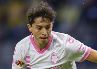 Santos mermado para su duelo ante el América