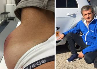 Atropellan a Luis Moya y así le queda su cadera
