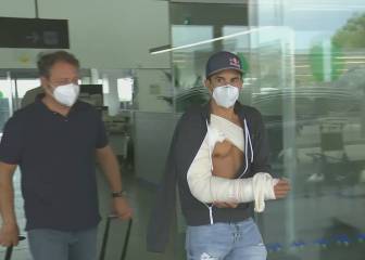 Pendientes del nervio radial