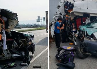 Un milagro salva la vida de los gemelos Öncü en Turquía