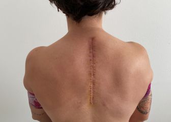 La recuperación de Ana Carrasco va más rápido de lo previsto