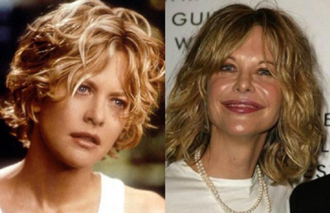 Meg Ryan antes y después