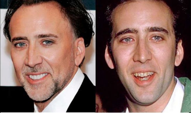 Nicolas Cage antes y después