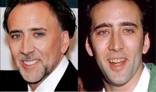 Nicolas Cage antes y después