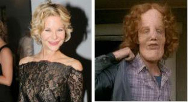 La burla lleva a compararla con el rostro del protagonista de la película 'El Hombre Elefante'.