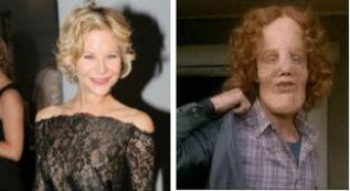 La burla lleva a compararla con el rostro del protagonista de la película 'El Hombre Elefante'.