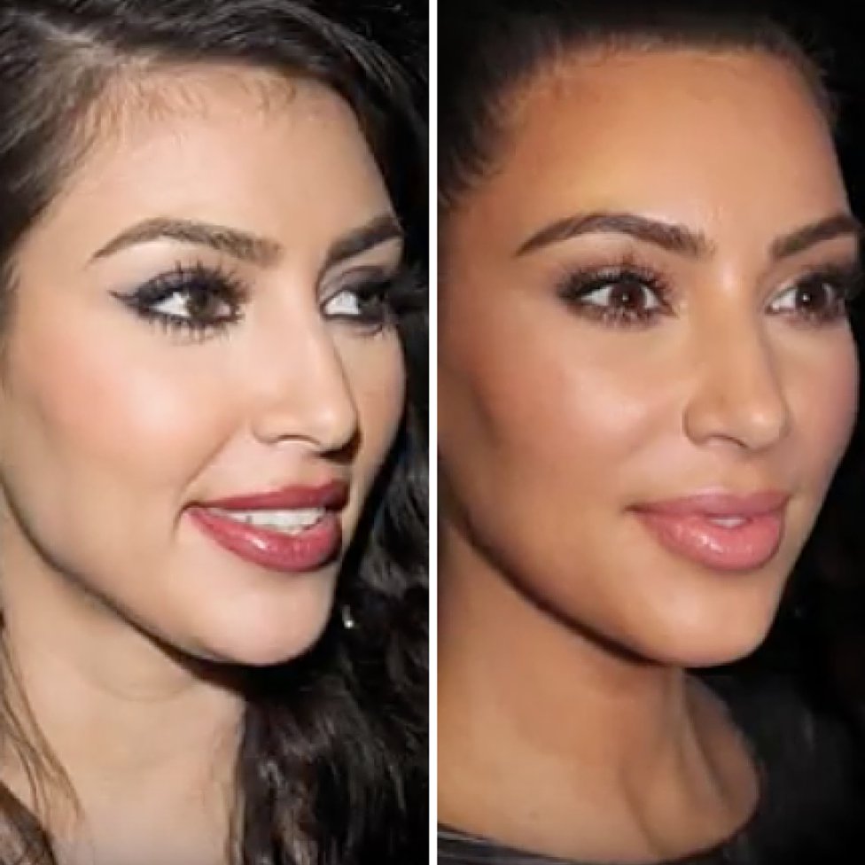 Antes Y Después Todas Las Operaciones De Kim Kardashian Antes Y Después 