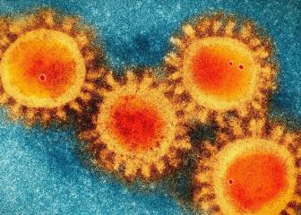 Coronavirus Perú: características y cómo se transmite
