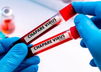Virus Chapare: ¿qué se sabe del virus que fue detectado en Bolivia?
