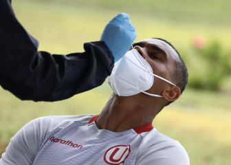 La Liga 1 arriesga la salud de futbolistas y trabajadores