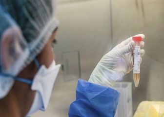 Variante Delta en Lima: qué se sabe y casos confirmados