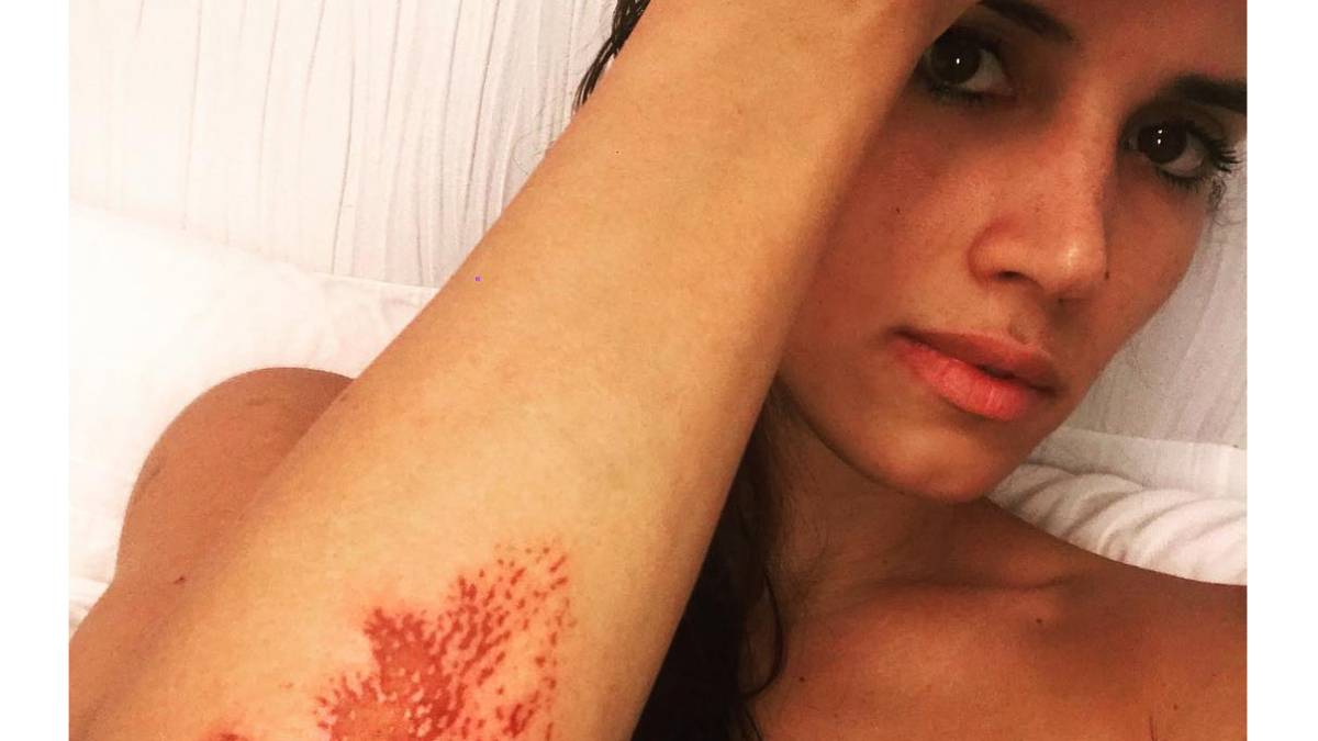 India Martnez Acaba Herida Tras Ser Atracada En La Calle AScom