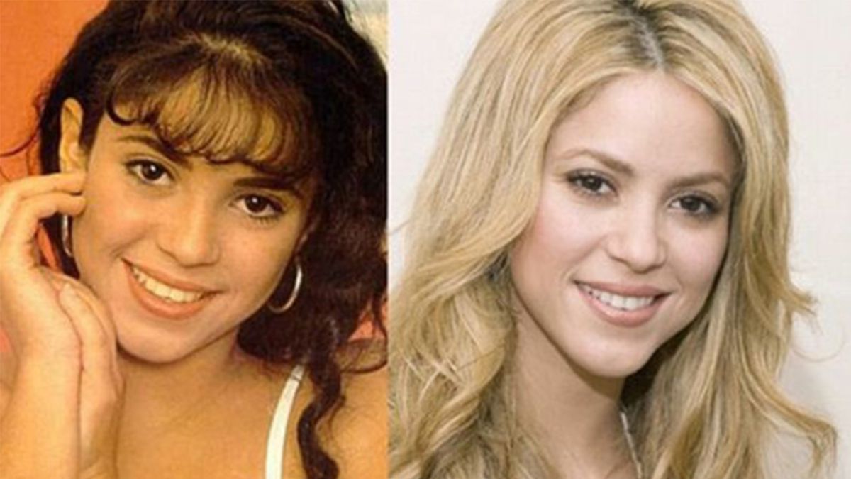 El antes y el después de Shakira: más de 63.000 euros en retoques