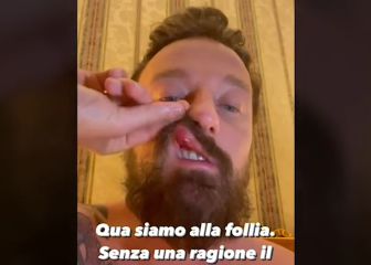McGregor golpea a un DJ en Roma y este lo denuncia en rrss