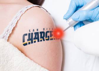 Empresa quita tatuajes gratis a los aficionados de los Chargers