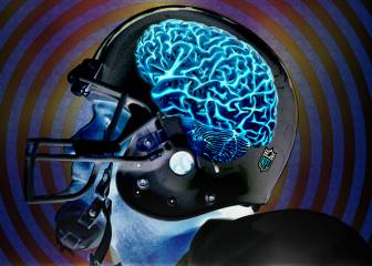Síntomas de CTE en 99% de exjugadores de la NFL