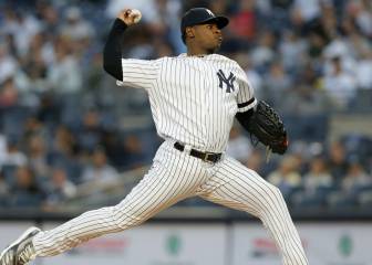 Severino se pierde todo el año por la Tommy John