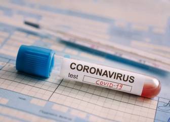 Prueba del coronavirus: dónde hacerla y cuánto cuesta en USA