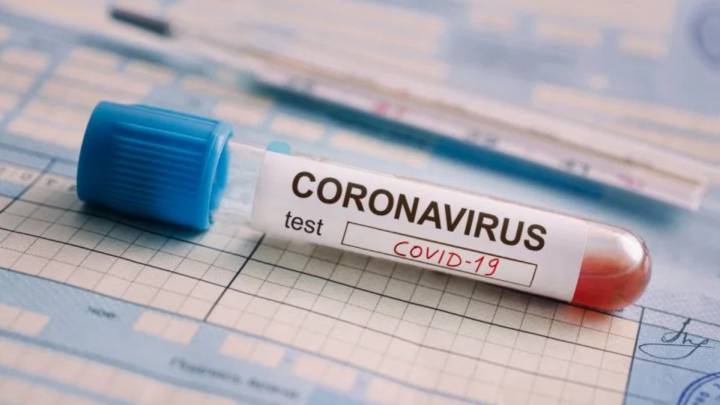 Prueba del coronavirus: dónde hacerla y cuánto cuesta en USA