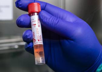 Test del coronavirus: cómo funciona, quién lo hace y precisión