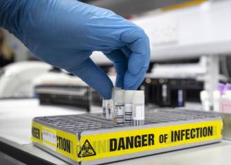 Coronavirus Antibody Test: qué son y para qué sirven 