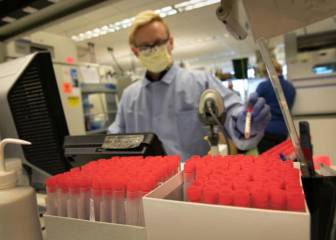 Infectados con coronavirus son propensos a derrames graves