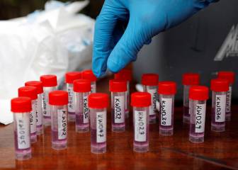 USA desarrolla nueva prueba para detectar coronavirus