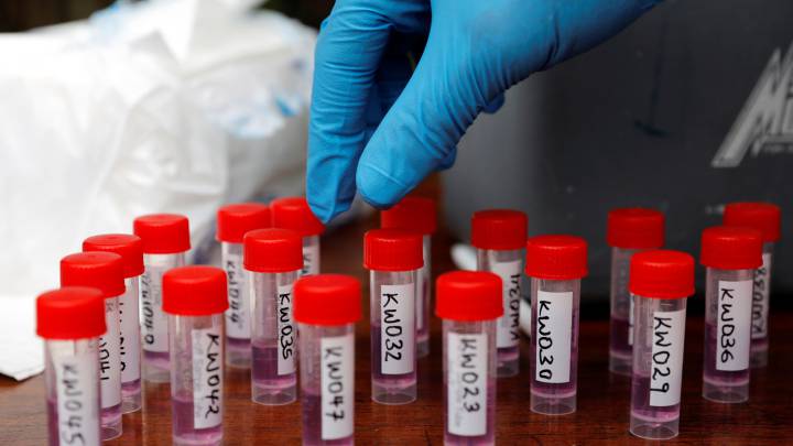 USA desarrolla prueba para detectar coronavirus en menos de 24 horas