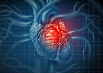 COVID-19 puede dejar lesiones permanentes en el corazón