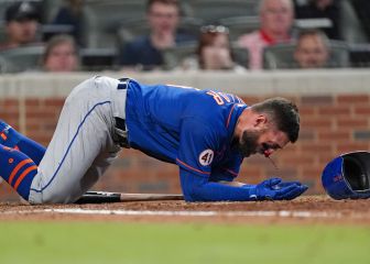 Pillar recibe pelotazo en la cara durante el Mets vs Braves