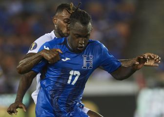 USA, consciente de la amenaza que representa Albert Elis