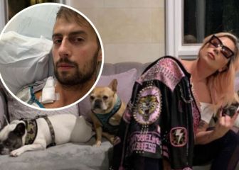Paseador de perros de Lady Gaga pide ayuda tras el asalto