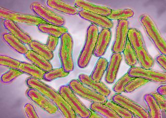 Más de la mitad de Estados Unidos con salmonella