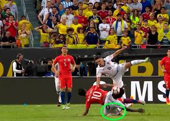 El brutal choque que provocó esta terrible lesión en el 'Tucu'