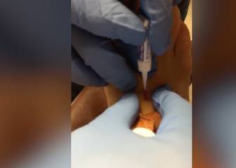 Filipe Luis posts video of doctors healing his gruesome injury