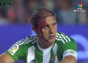 Joaquín y su cara llena de sangre tras sufrir un duro golpe
