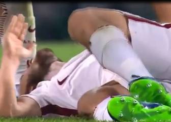 Jugador de la Roma se fracturó en una desafortunada acción