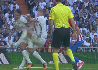 Pepe choca con Kroos y tiene que abandonar el partido